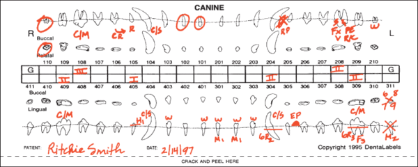 DentaLabels Demo Chart